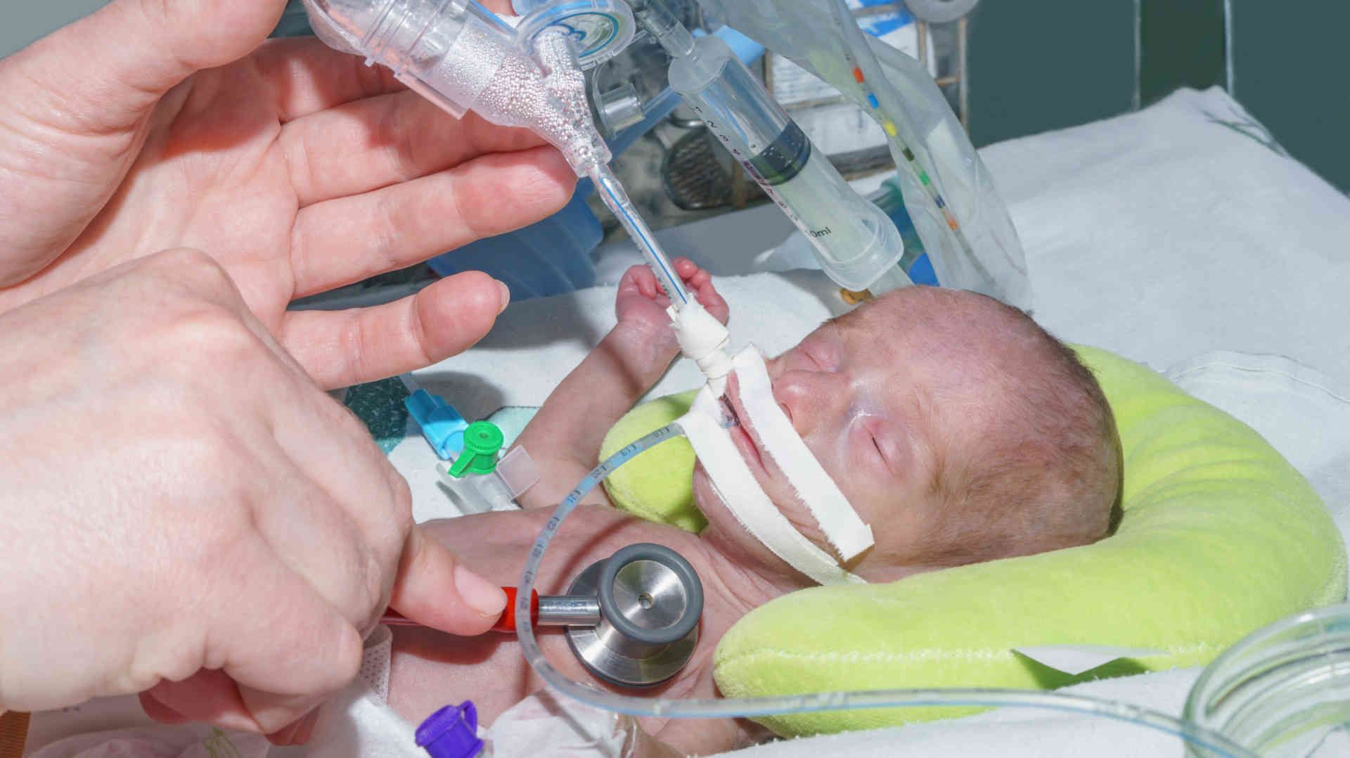 COVID-19 pneumonia on CT