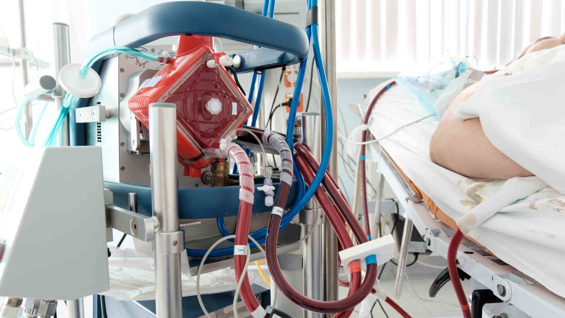 ECMO machine beside a patient