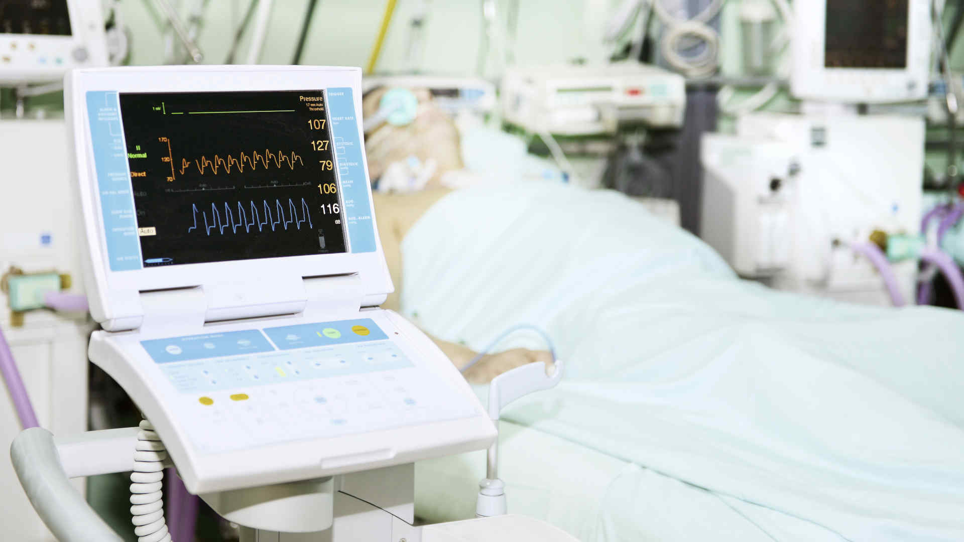 Intra-aortic balloon pump with a ventilated patient in the background