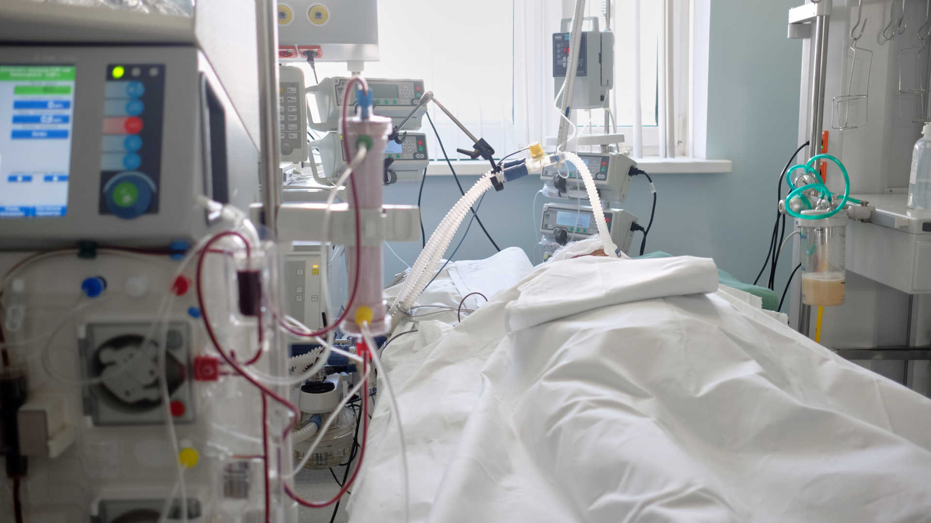 ICU patient with multi-organ failure