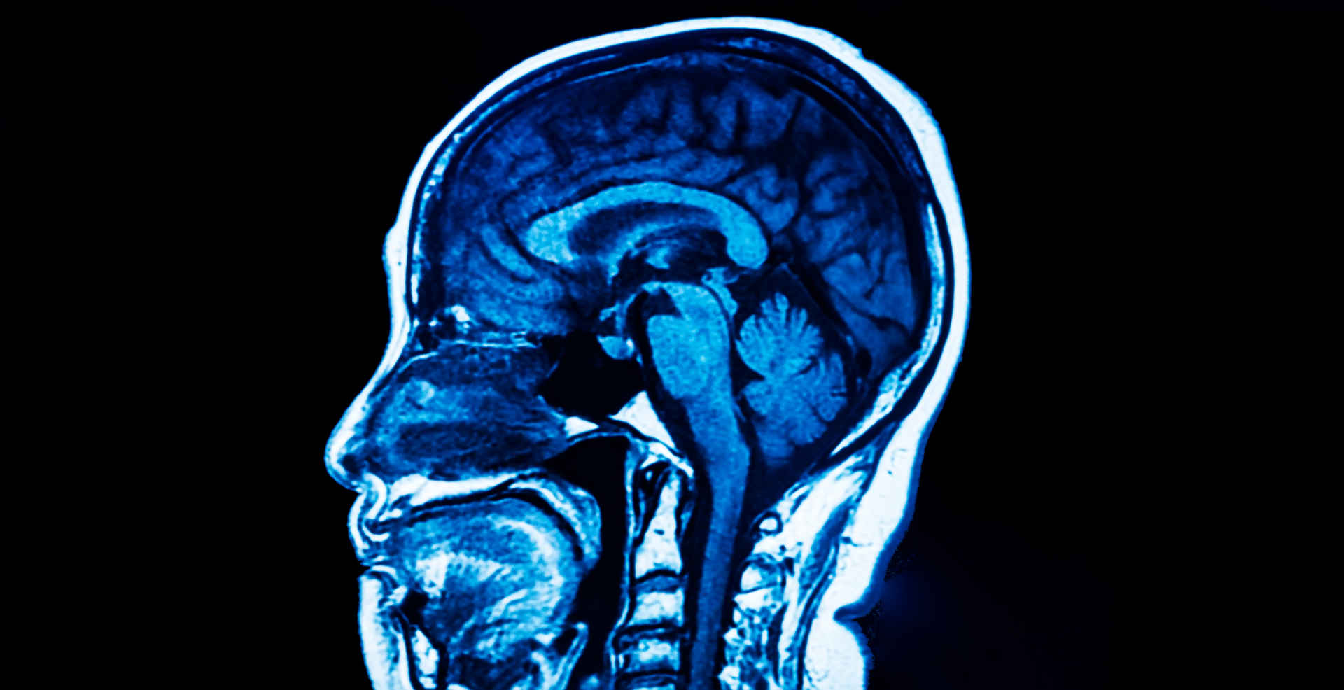 Sagittal brain section on MRI