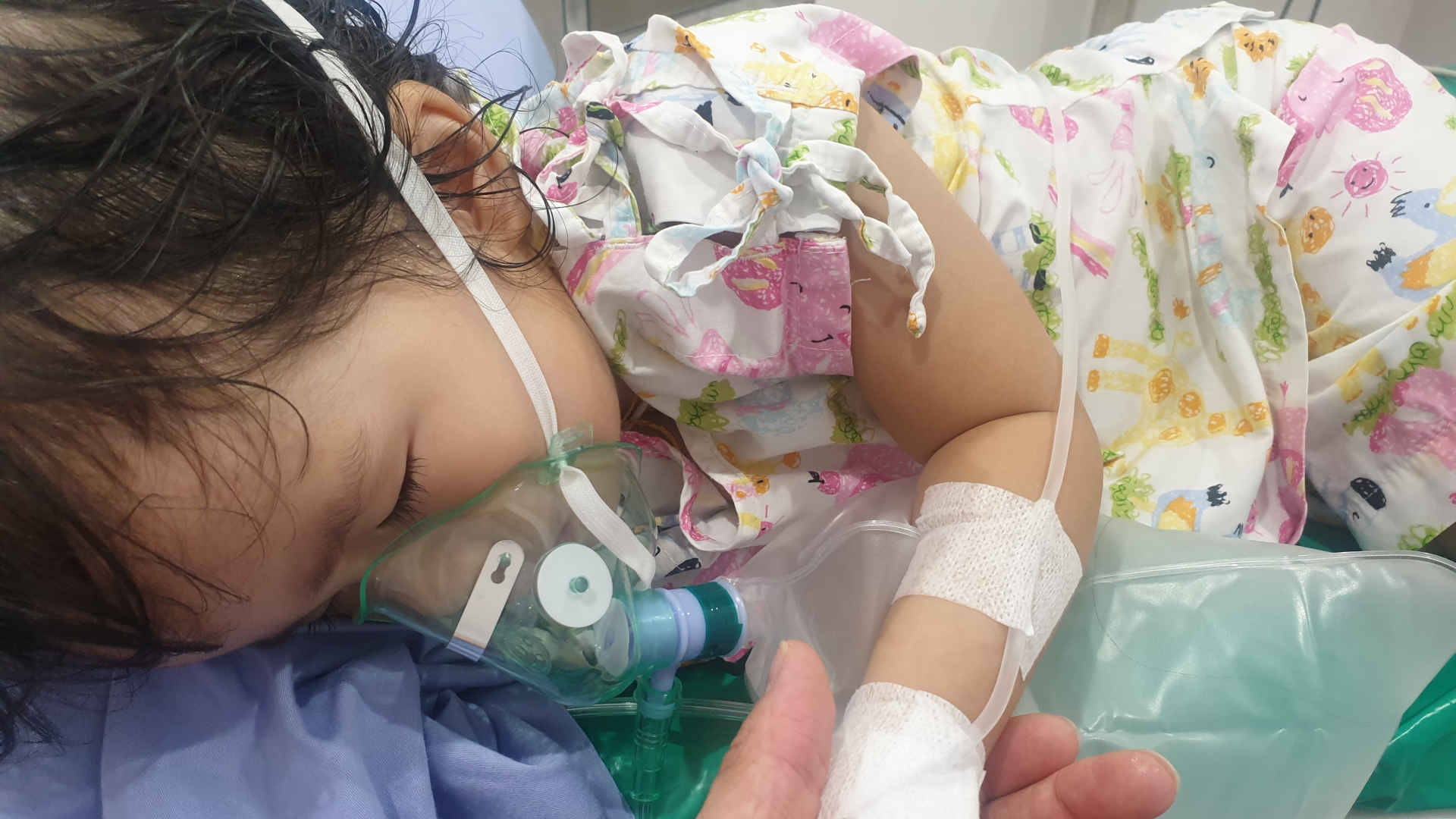 Infant lying semi-prone having a nebuilser