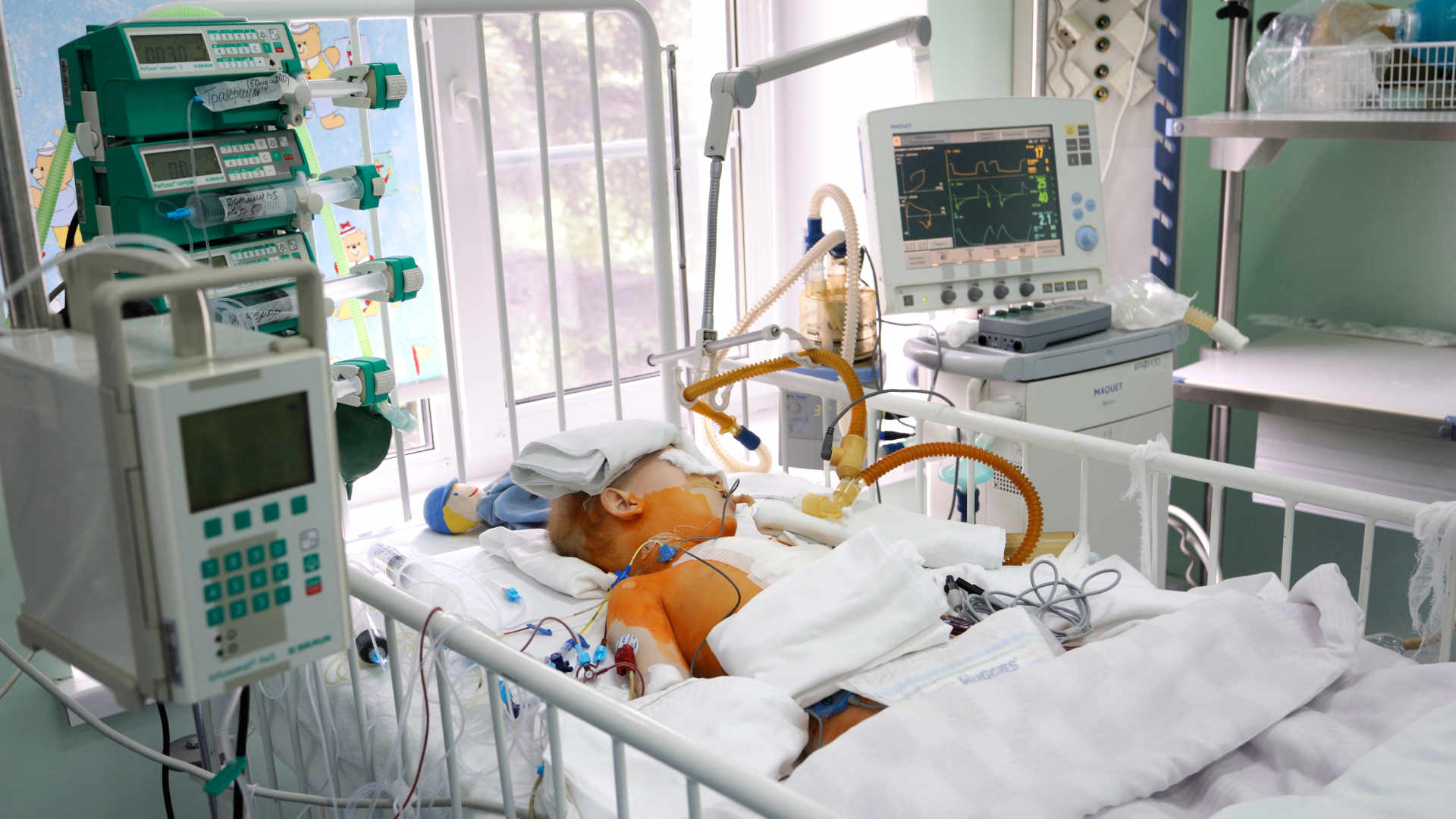 Paeditric ICU patient