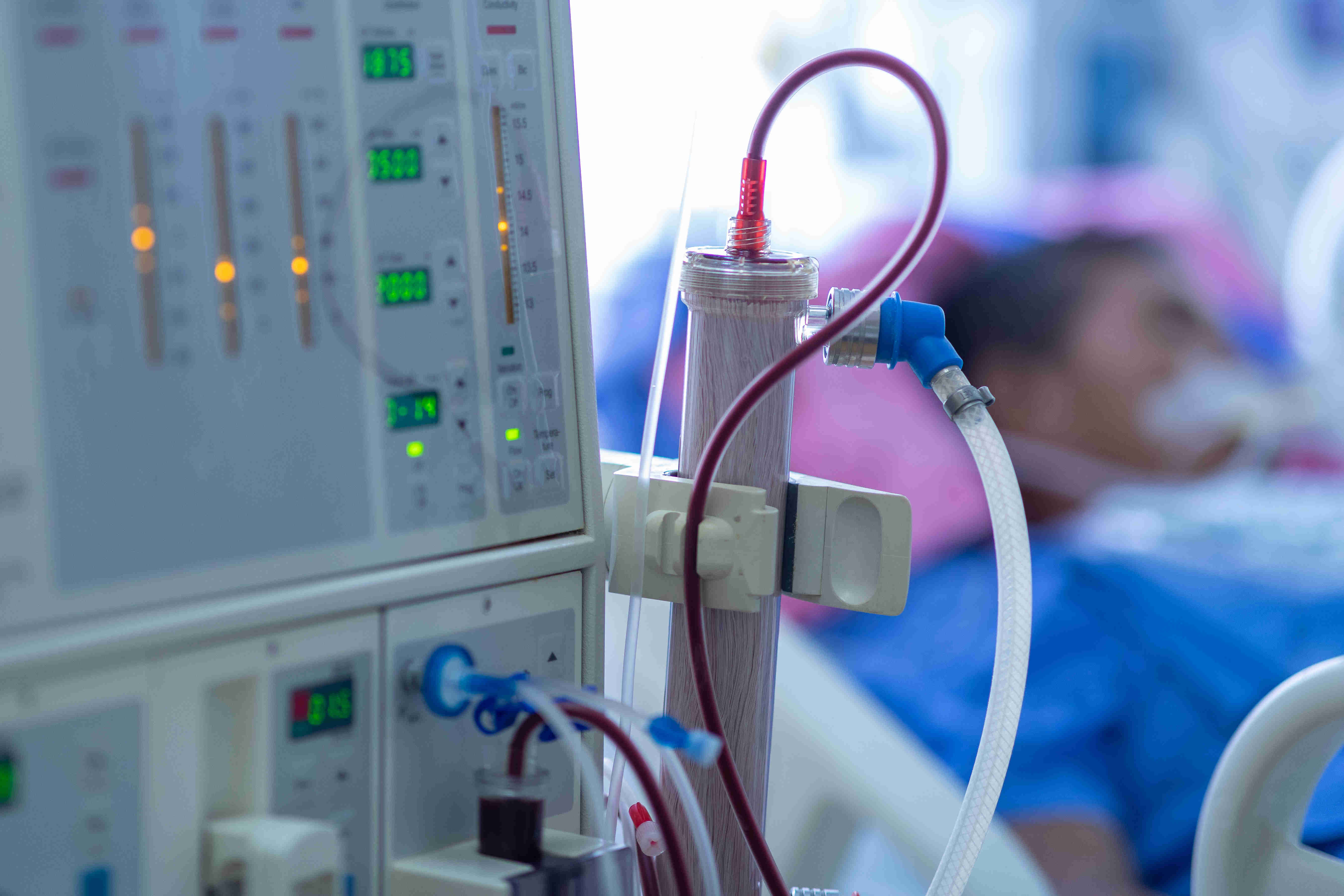 CRRT machine in front of an ICU patient