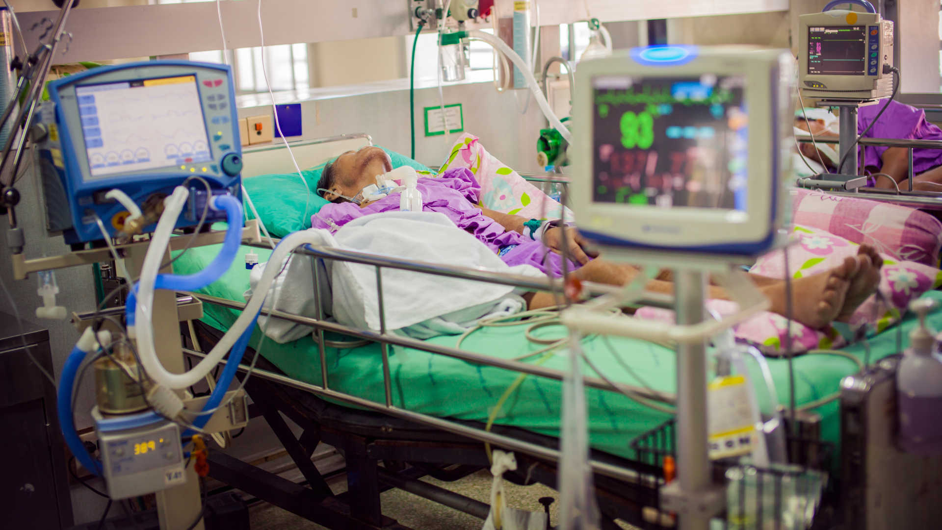 Ventilated ICU patient with a tracheostomy tube