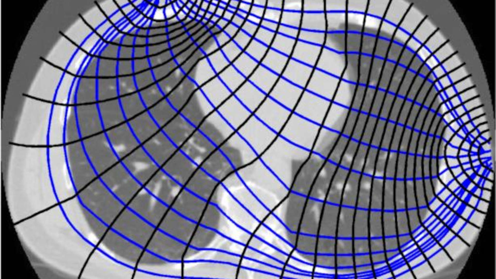 Foot protruding from end of bed