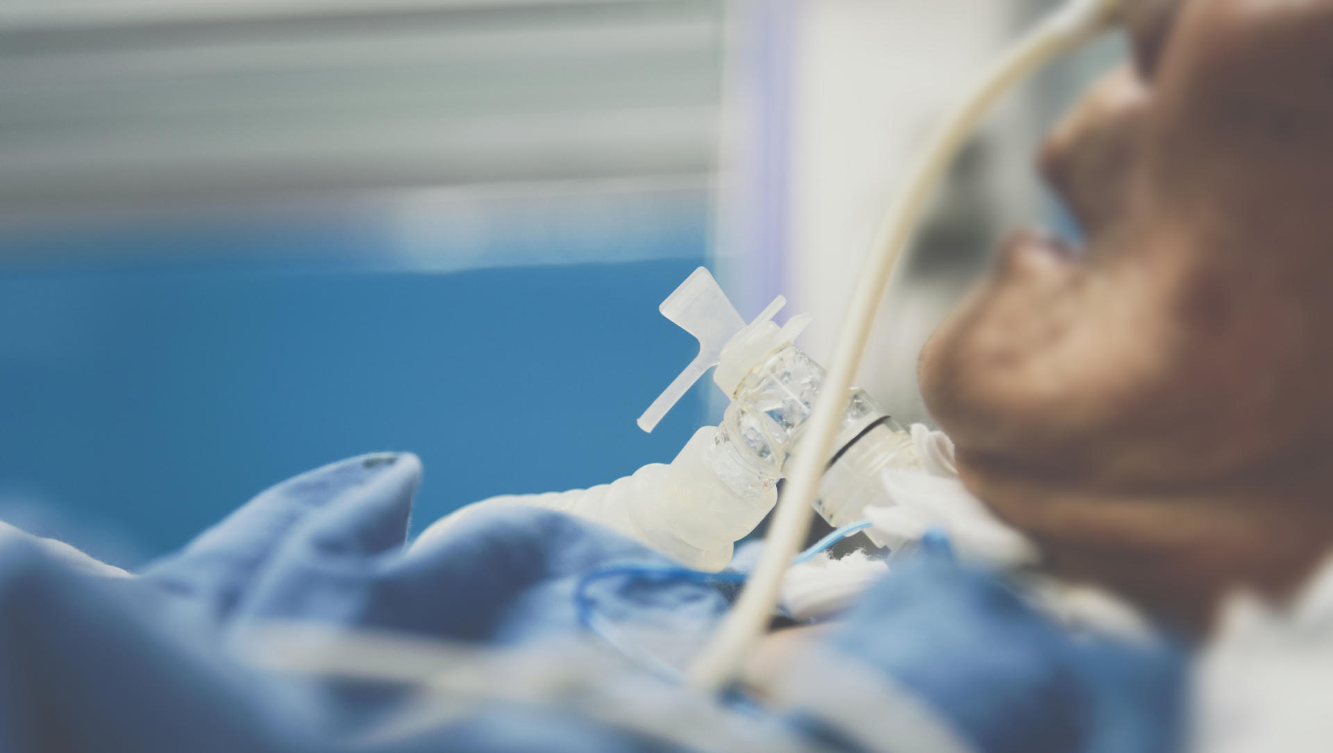 Ventilated ICU patient with a tracheostomy tube