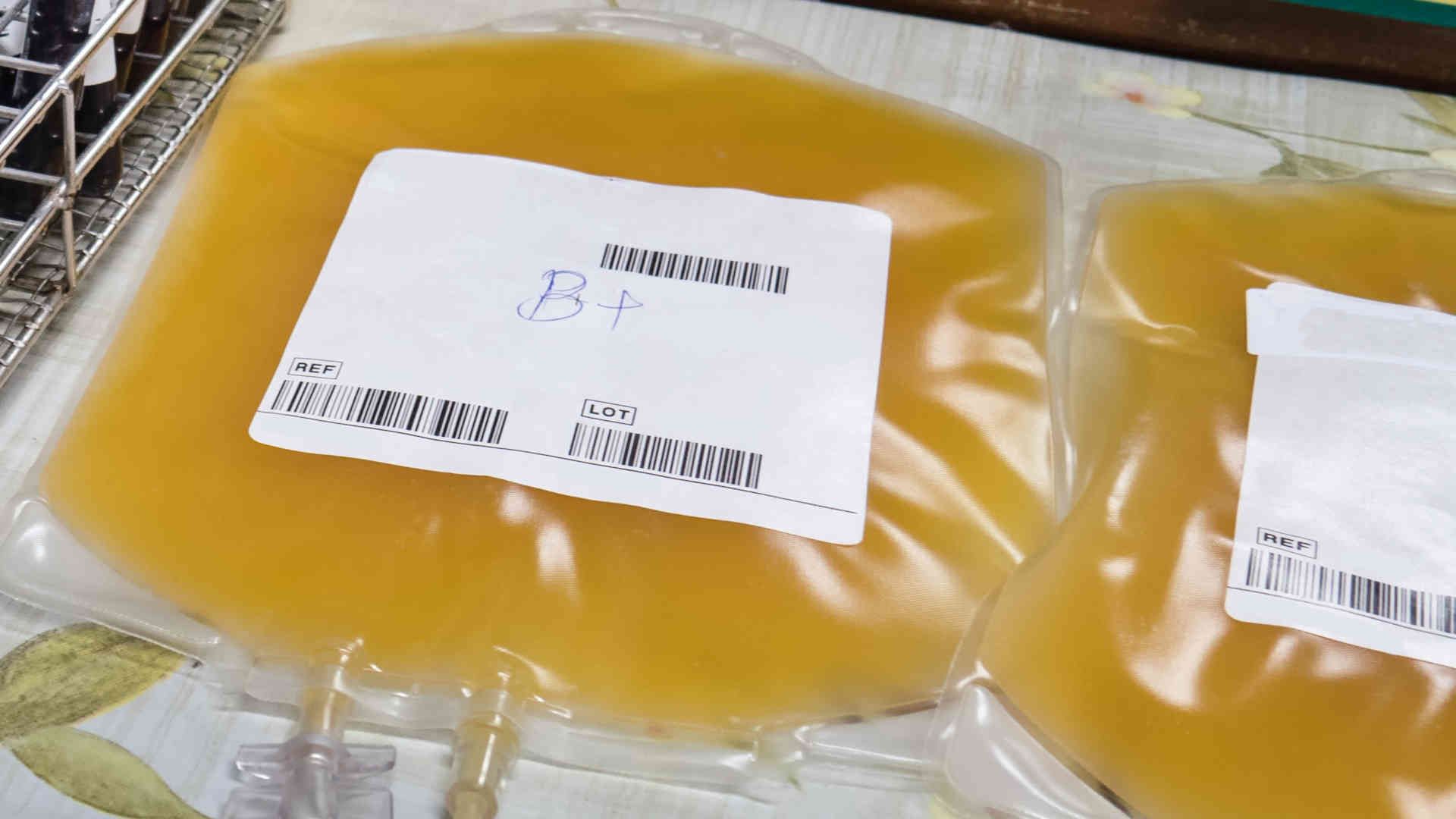 Bags of platelets