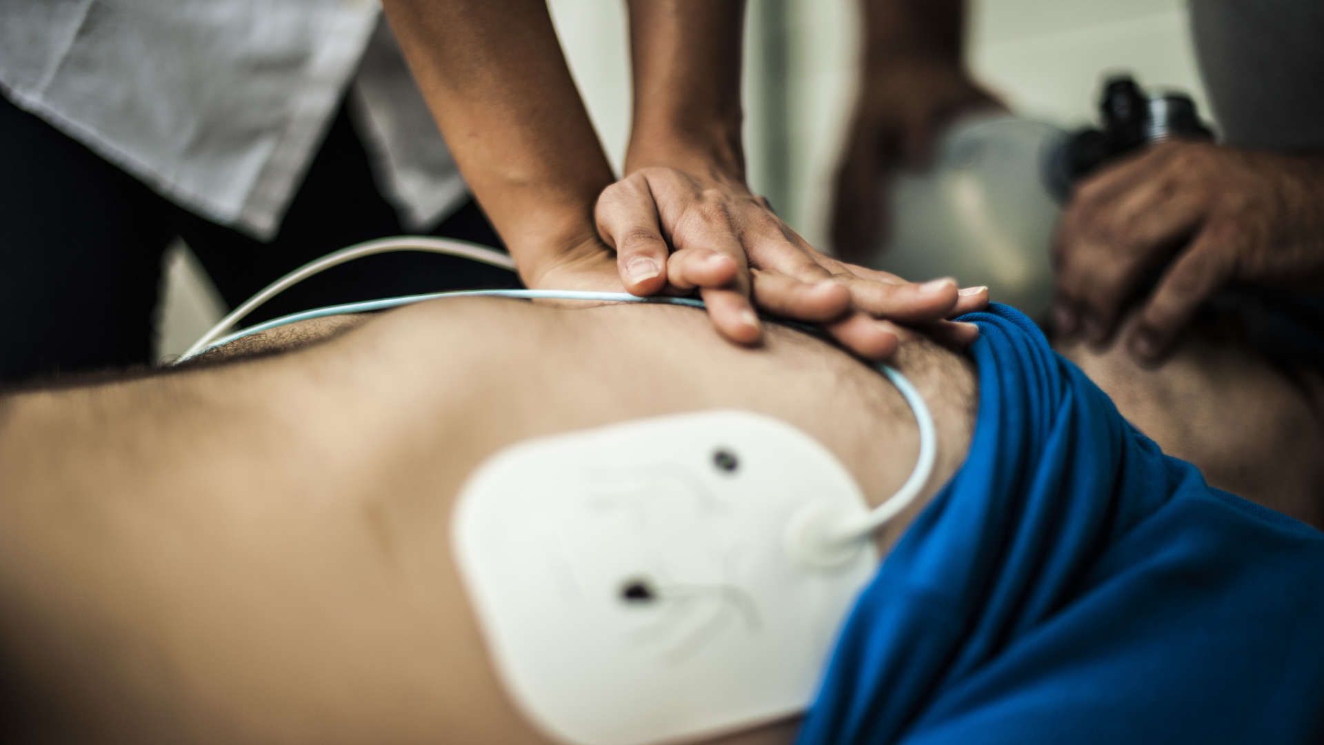 Patient, with defibrillation pads attached, undergoing CPR