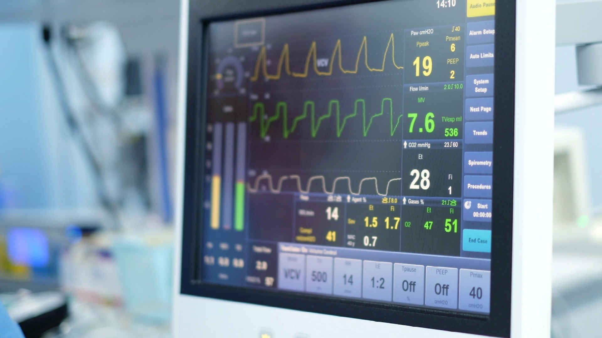 Screen of a mechanical ventilator in the ICU