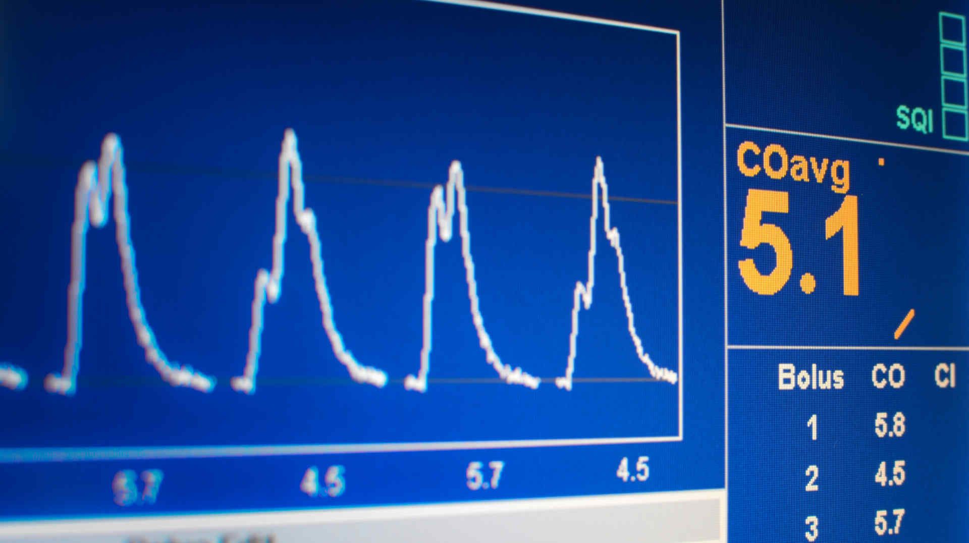 Cardiac output monitor screen