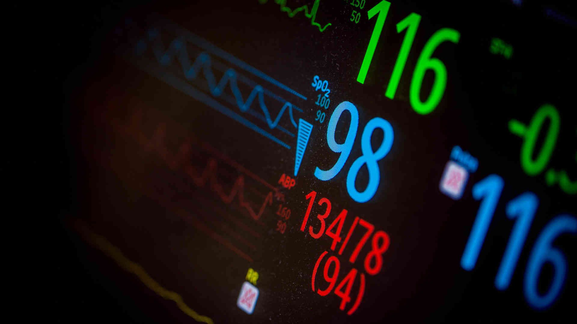 ICU monitor screen