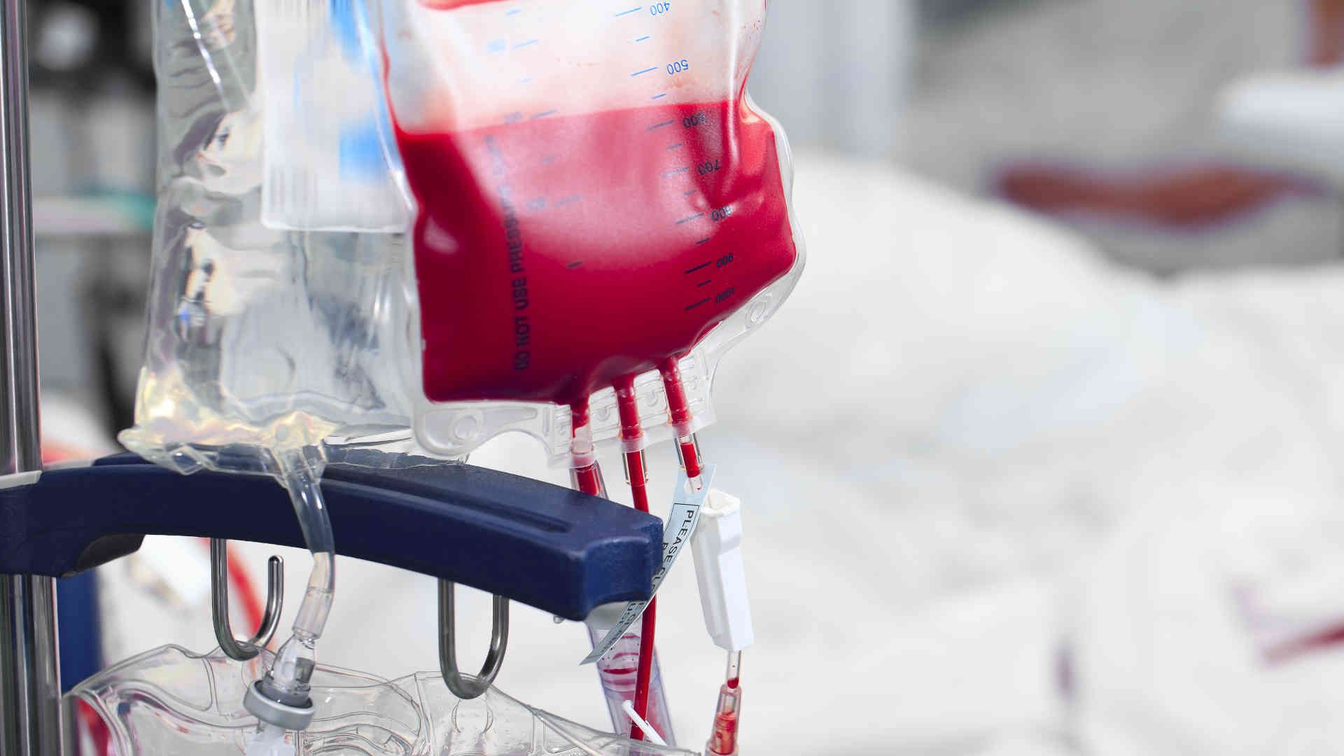 Unit of red cells being transfused