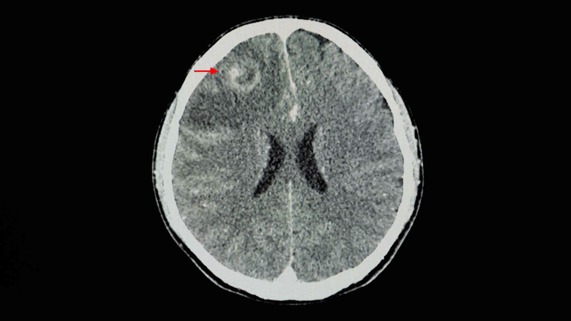 FAST scan with liver and kidney identified