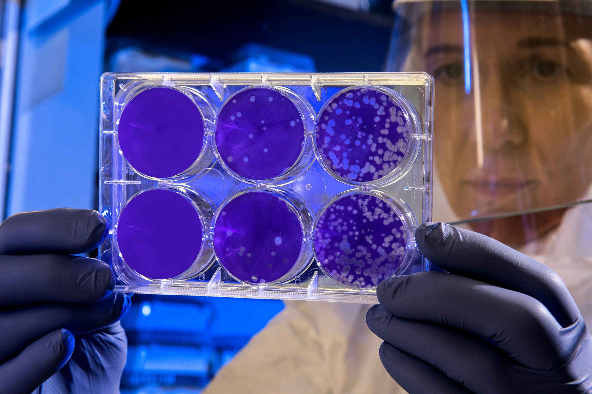 Microbiologist looking at agar plates